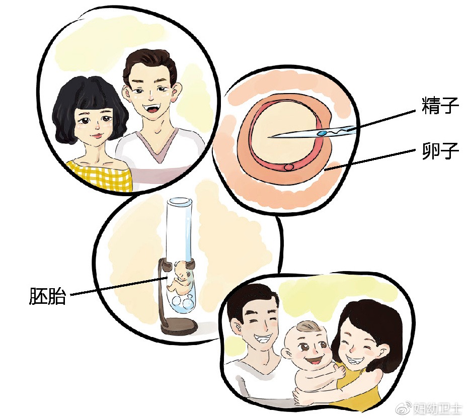 丽水试管婴儿助孕