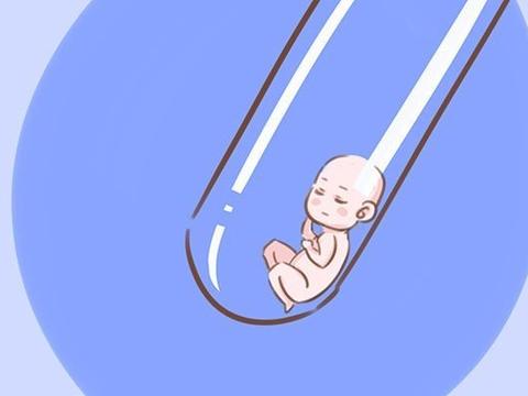 第四代试管婴儿