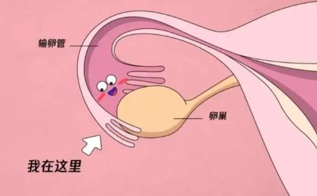 二代试管婴儿