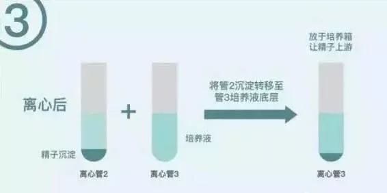 九院试管