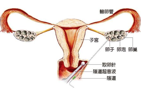 胎儿亲子鉴定