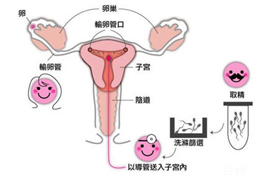 丽水试管婴儿