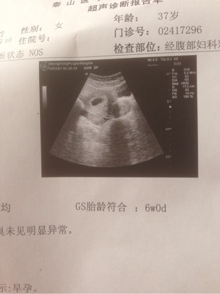 丹东试管婴儿