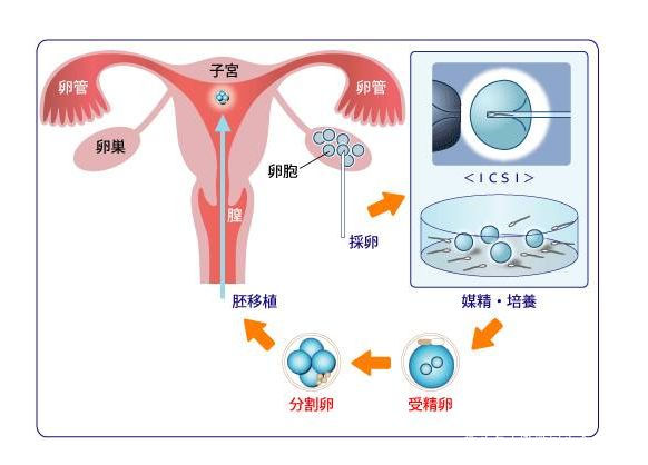 上海供卵试管婴儿