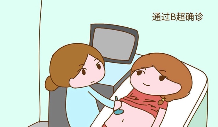 上海捐卵代怀孕