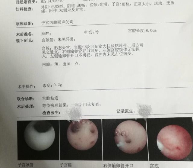 上海代怀孕捐卵女生